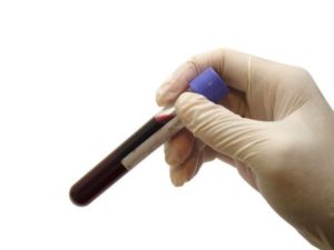 Marijuana DUI Blood Test
